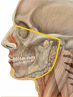 Orofacial pain Lateral head skull
