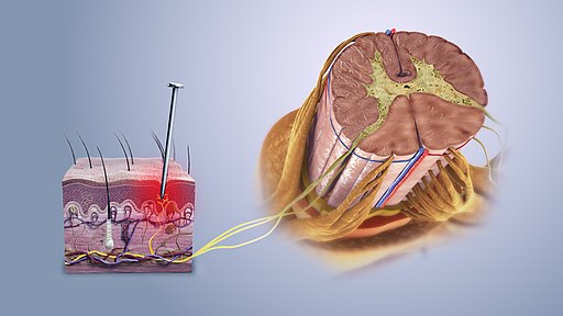 Nociceptive pain