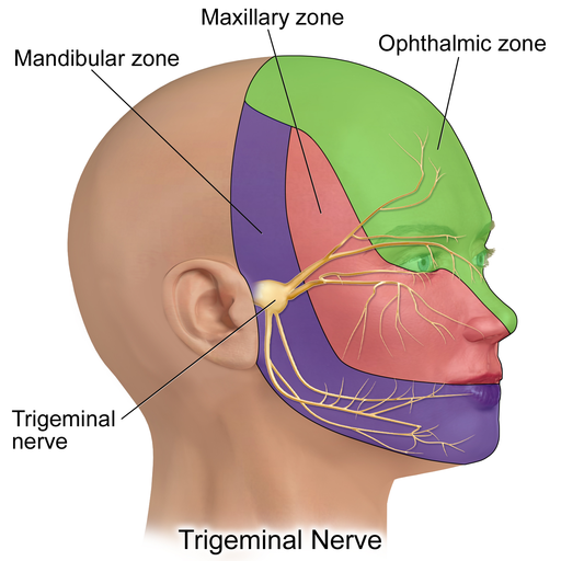 severe migraine headaches