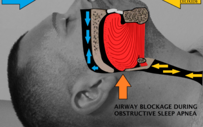 Dental Exam Guide for New Patients with Obstructive Sleep Apnea