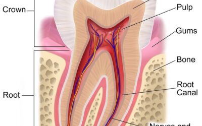 What is Tooth Erosion? Causes, Diagnosis, and Treatment