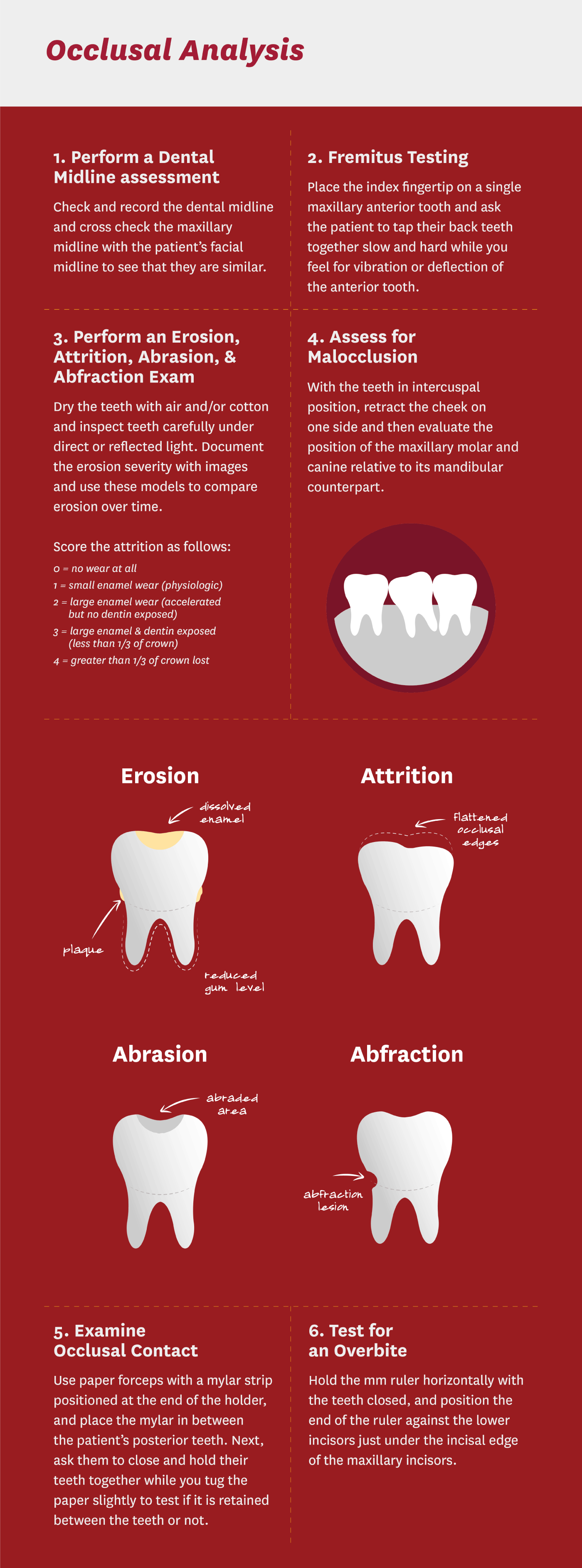 How to Perform an Occlusal Analysis Infographic