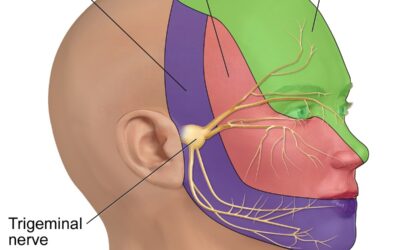 5 Steps to Accurately Diagnose Chronic Trigeminal Neuropathy