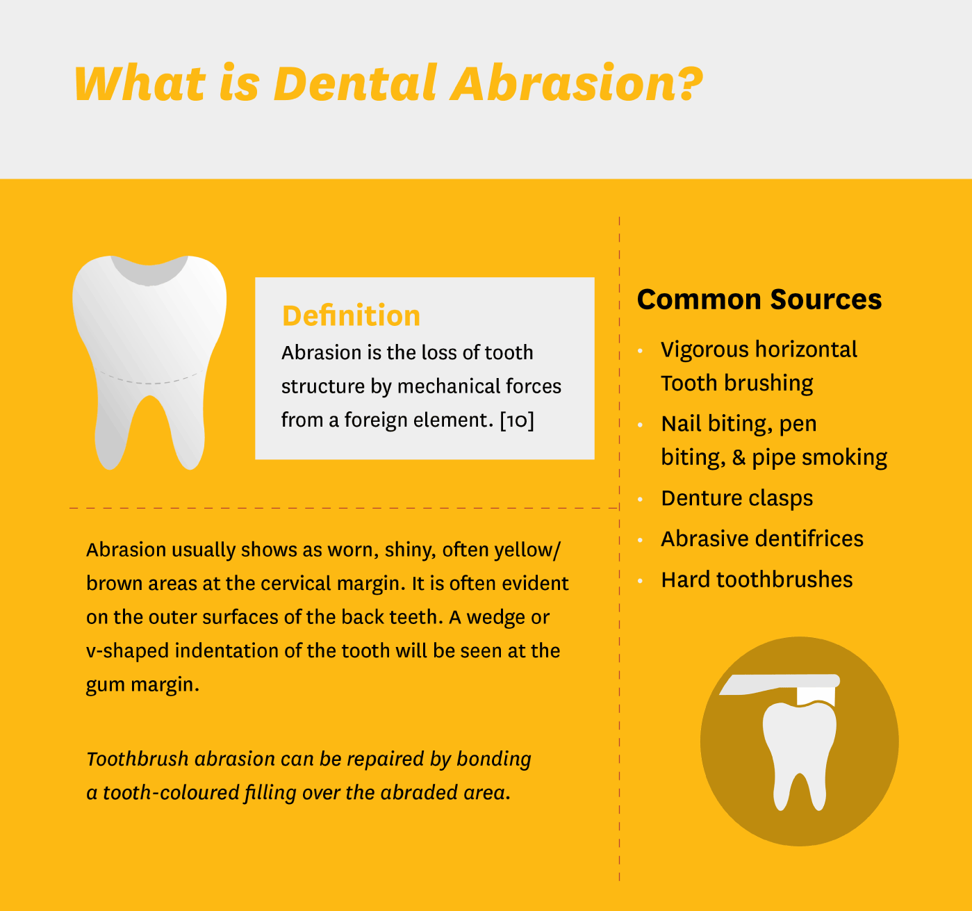What is Dental Abrasion Infographic Title Slide