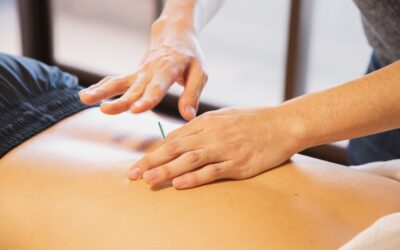 Does Acupuncture Really Work For Pain?