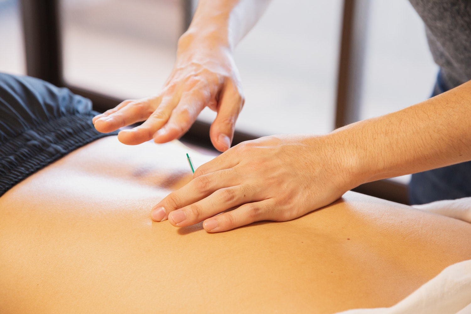 Acupuncture with Electric Stimulation - Acupuncture & Physical Therapy  Specialist