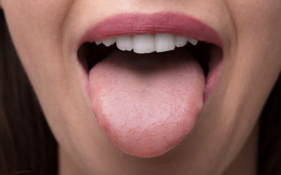 Why is a Tongue Evaluation Important?