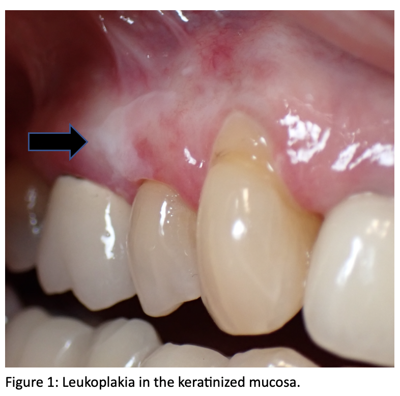 Which condition is not 2025 diagnosed through clinical appearance