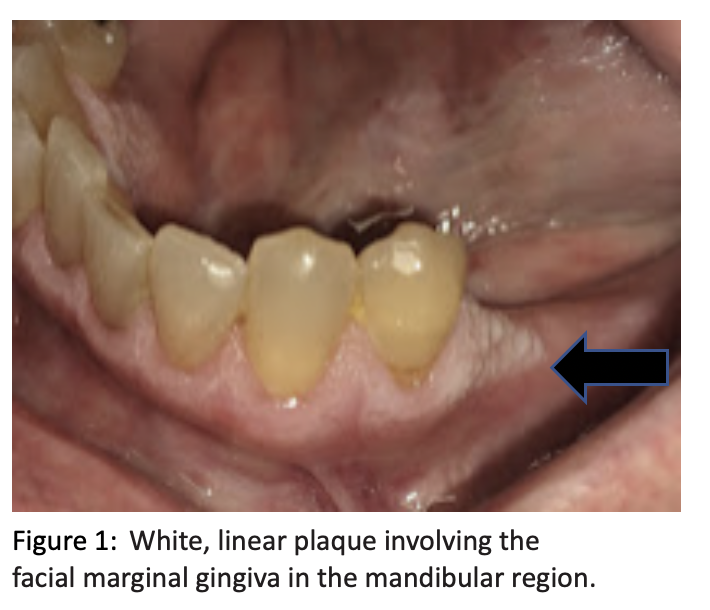 Which condition is not 2025 diagnosed through clinical appearance