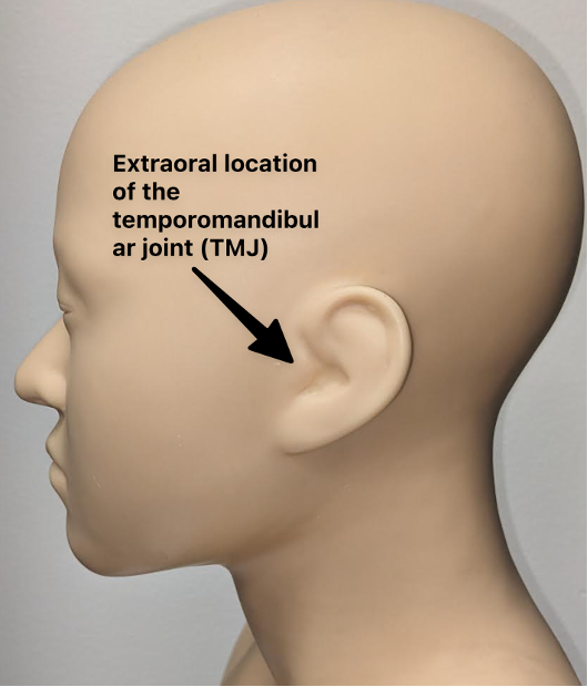 Mannequin with a black arrow showing the extraoral location of the TMJ (temporomandibular joint) in front of the ear.