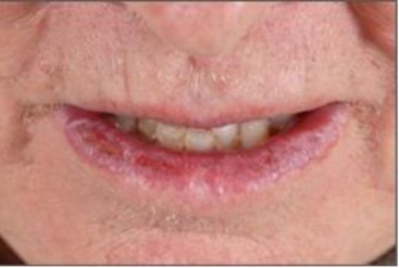Older lady's mouth