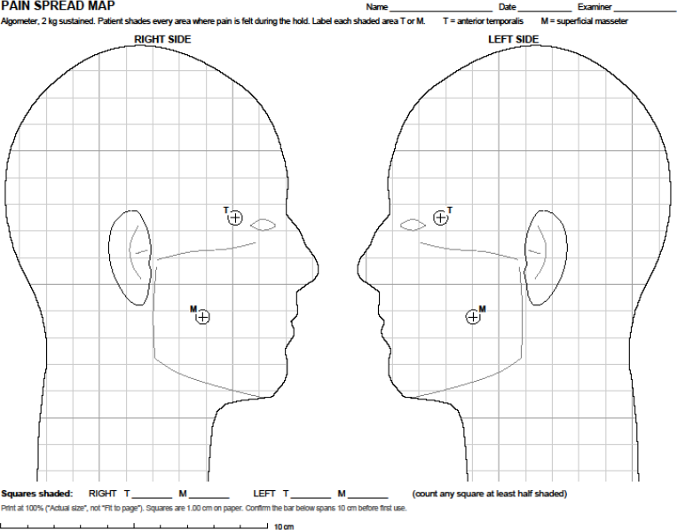 Figure 2. Pain spread map. The patient shades every area where pain is felt during the five-second sustained load. Shaded squares are counted and the sheet is filed in the chart, so the record is the picture rather than a description of it.