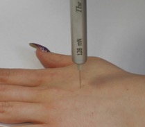 Figure 4. Temporal summation. A weighted pinprick, rated once, then delivered ten times at about one per second with the peak rated again. Record the difference between the two ratings, not the ratio.